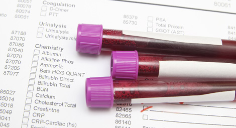 Three vials containing blood samples